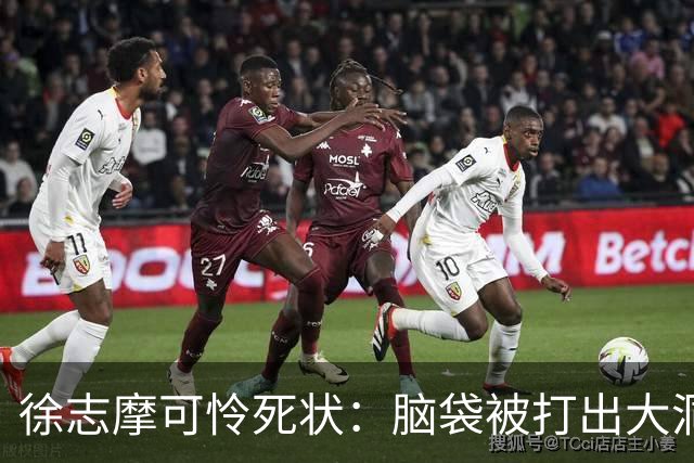 徐志摩可怜死状：脑袋被打出大洞，四肢被烈火炙烤成焦炭！